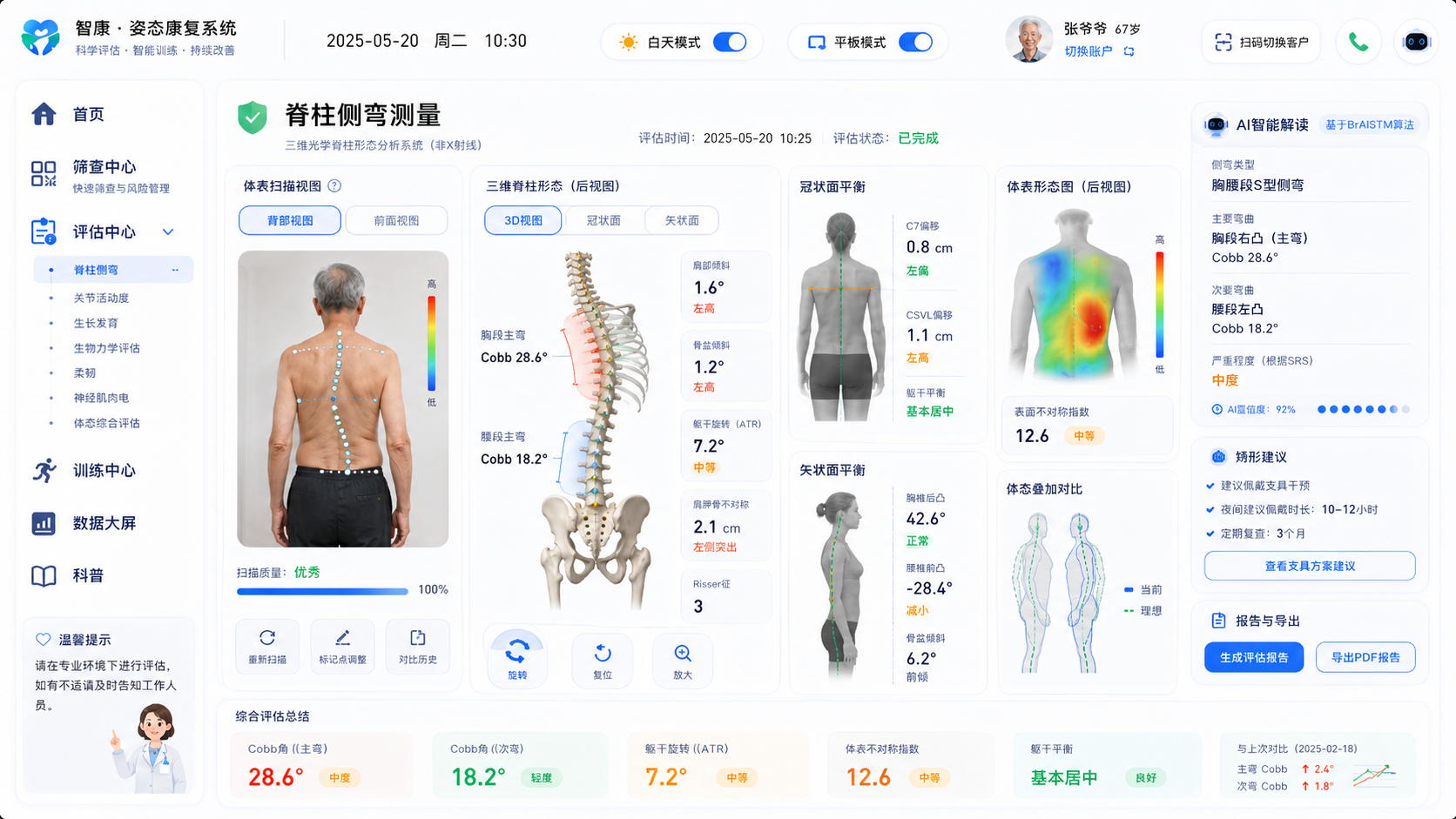 脊柱侧弯测量系统界面，展示体态、三维脊柱与 Cobb 角