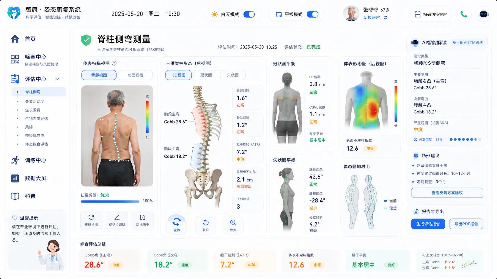 脊柱侧弯测量系统界面,展示体态、三维脊柱与 Cobb 角